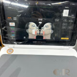 Ultherapy PRIME HIFU 2025 microfocused ultrasound skin lifting and tightening system