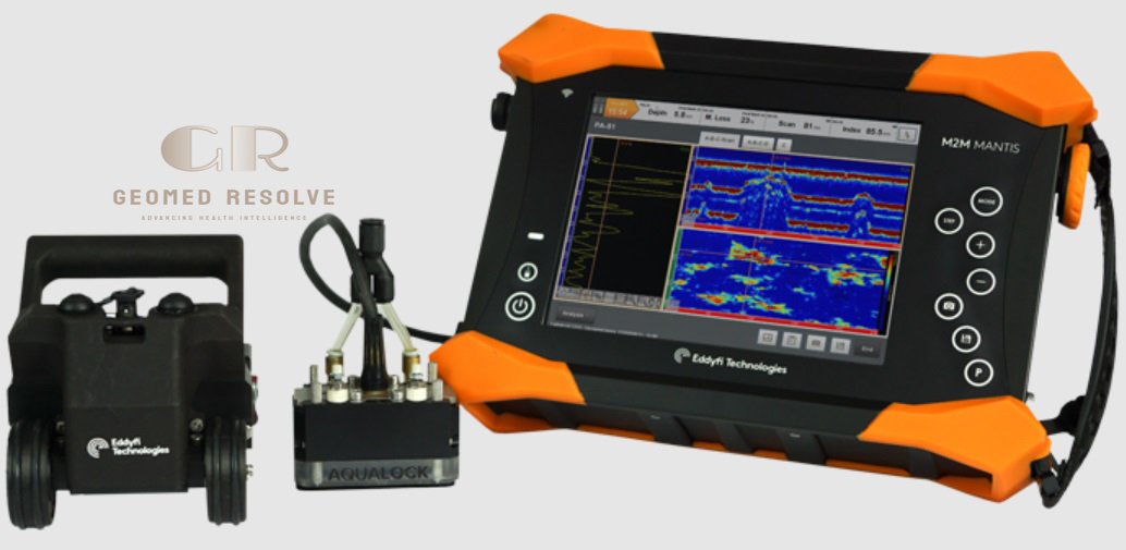 Eddyfi Mantis Portable Phased Array Ultrasonic Inspection System Eddyfi Mantis portable phased array ultrasonic flaw detector for industrial non-destructive testing and weld inspection